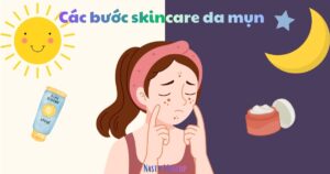 Các bước skincare da mụn