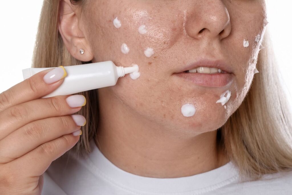 Các bước skincare da mụn ban đêm