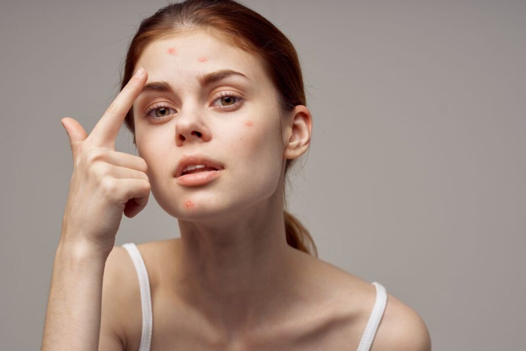 Lưu ý khi thực hiện các bước skincare cho da dầu mụn sáng và tối